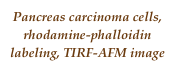 Pancreas carcinoma cells, rhodamine-phalloidin labeling, TIRF-AFM image